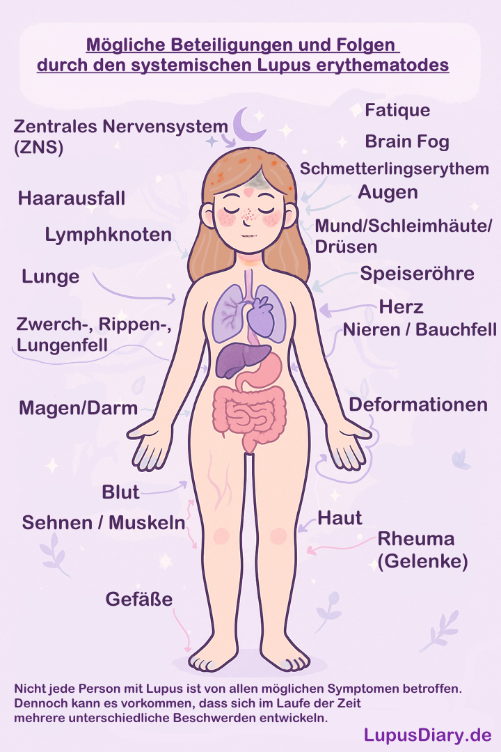 Illustration einer Frau mit markierten möglichen Krankheitsbeteiligungen bei systemischem Lupus erythematodes.