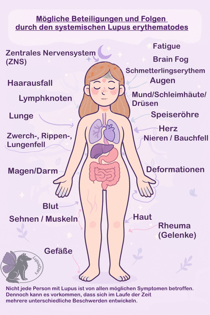 Illustration einer Frau mit markierten möglichen Krankheitsbeteiligungen bei systemischem Lupus erythematodes.